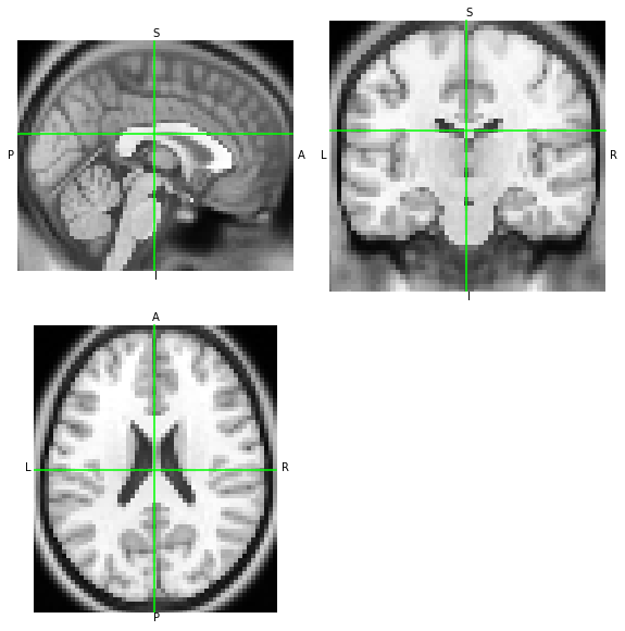 ../_images/notebooks_Reading_and_Writing_transforms_12_1.png