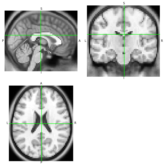 ../_images/notebooks_Reading_and_Writing_transforms_12_2.png