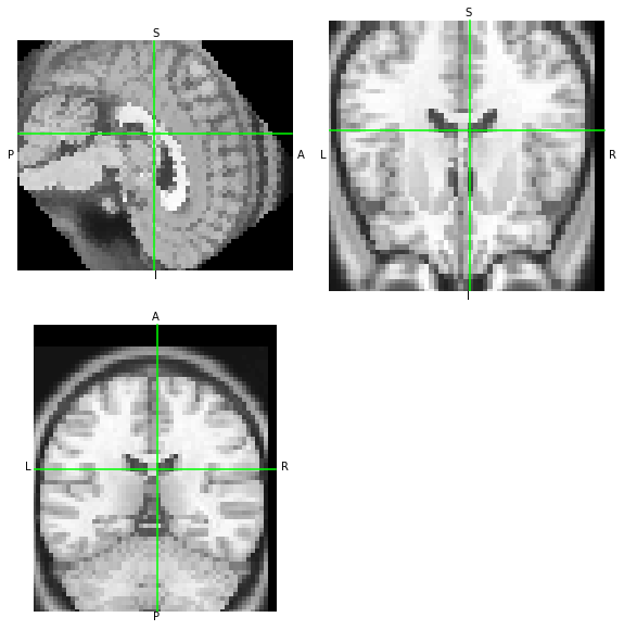../_images/notebooks_Reading_and_Writing_transforms_19_1.png