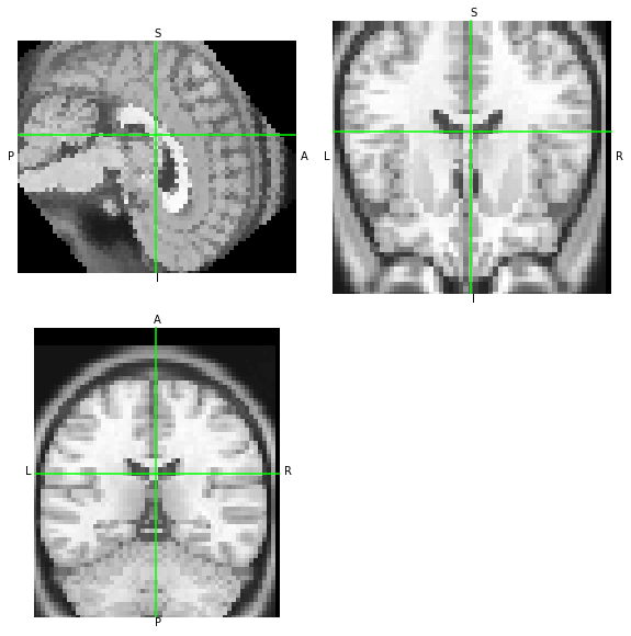 ../_images/notebooks_Reading_and_Writing_transforms_31_1.png