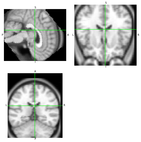 ../_images/notebooks_Reading_and_Writing_transforms_33_1.png