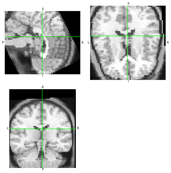 ../_images/notebooks_Reading_and_Writing_transforms_49_1.png