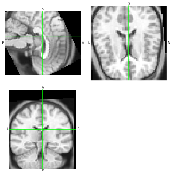 ../_images/notebooks_Reading_and_Writing_transforms_49_2.png